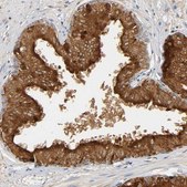Anti-ACPP antibody produced in rabbit Prestige Antibodies&#174; Powered by Atlas Antibodies, affinity isolated antibody, buffered aqueous glycerol solution