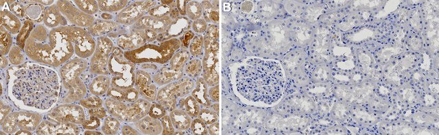 Anti-BRCC3 Antibody, clone 2M19 ZooMAb&#174; Rabbit Monoclonal recombinant, expressed in HEK 293 cells