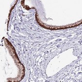 Anti-PRR15 antibody produced in rabbit Prestige Antibodies&#174; Powered by Atlas Antibodies, affinity isolated antibody, buffered aqueous glycerol solution