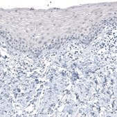 Monoclonal Anti-CT83 antibody produced in mouse Prestige Antibodies&#174; Powered by Atlas Antibodies, clone CL4762, purified immunoglobulin