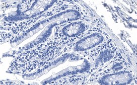Anti-PUMA Antibody, clone 1L16 ZooMAb&#174; Rabbit Monoclonal recombinant, expressed in HEK 293 cells