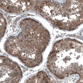Anti-UMPS antibody produced in rabbit Prestige Antibodies&#174; Powered by Atlas Antibodies, affinity isolated antibody, buffered aqueous glycerol solution