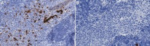 Anti-IDO1 Antibody, clone 1B17 ZooMAb&#174; Rabbit Monoclonal recombinant, expressed in HEK 293 cells