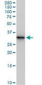 Anti-ANXA5 antibody produced in mouse purified immunoglobulin, buffered aqueous solution