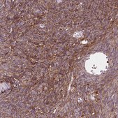 Anti-DCN antibody produced in rabbit Prestige Antibodies&#174; Powered by Atlas Antibodies, affinity isolated antibody