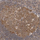 Anti-WDR77 antibody produced in rabbit Prestige Antibodies&#174; Powered by Atlas Antibodies, affinity isolated antibody, buffered aqueous glycerol solution, ab3
