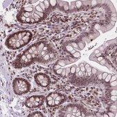 Anti-PER2 antibody produced in rabbit Prestige Antibodies&#174; Powered by Atlas Antibodies, affinity isolated antibody, buffered aqueous glycerol solution