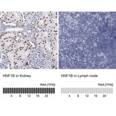 Anti-HNF1B antibody produced in rabbit Prestige Antibodies&#174; Powered by Atlas Antibodies, affinity isolated antibody, buffered aqueous glycerol solution