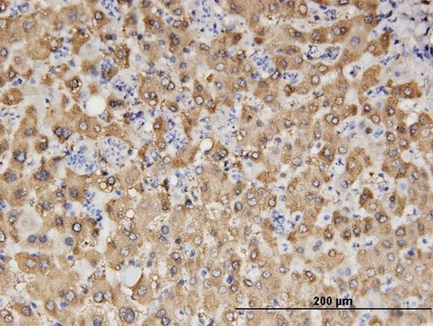 Monoclonal Anti-ALDH1A1 antibody produced in mouse clone 1G6, purified immunoglobulin, buffered aqueous solution