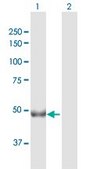 Anti-CHKA antibody produced in rabbit purified immunoglobulin, buffered aqueous solution