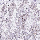 Anti-FASLG antibody produced in rabbit Prestige Antibodies&#174; Powered by Atlas Antibodies, affinity isolated antibody, buffered aqueous glycerol solution