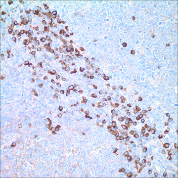 IgG Rabbit Polyclonal Antibody