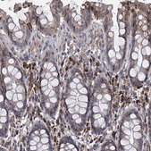 Anti-CCR4 antibody produced in rabbit Prestige Antibodies&#174; Powered by Atlas Antibodies, affinity isolated antibody, buffered aqueous glycerol solution