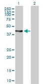 Anti-EPHX1 antibody produced in mouse purified immunoglobulin, buffered aqueous solution