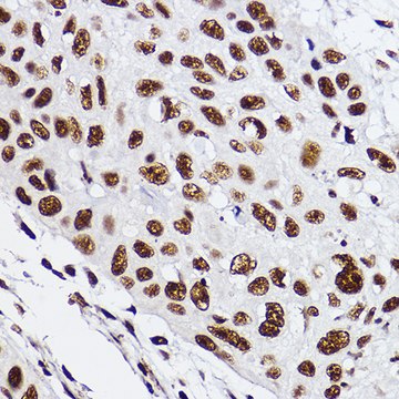 Anti-GTF2F2 Antibody, clone 3T7Q9, Rabbit Monoclonal