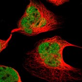 Anti-EP300 antibody produced in rabbit Ab2, Prestige Antibodies&#174; Powered by Atlas Antibodies, affinity isolated antibody, buffered aqueous glycerol solution