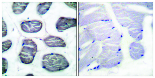 Anti-ACTIN-&#945;-1 antibody produced in rabbit affinity isolated antibody