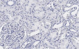 Anti-TSC2 Antibody, clone 4H10 ZooMAb&#174; Rabbit Monoclonal recombinant, expressed in HEK 293 cells