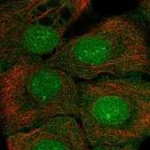 Anti-SETBP1 antibody produced in rabbit Prestige Antibodies&#174; Powered by Atlas Antibodies, affinity isolated antibody, buffered aqueous glycerol solution