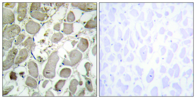 Anti-Collagen V &#945;1 antibody produced in rabbit affinity isolated antibody