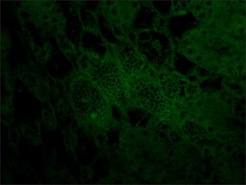 Anti-Podoplanin (HG-19) antibody produced in rabbit affinity isolated antibody, buffered aqueous solution