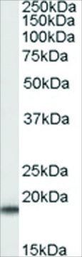 Anti-SOD1 antibody produced in goat affinity isolated antibody, buffered aqueous solution