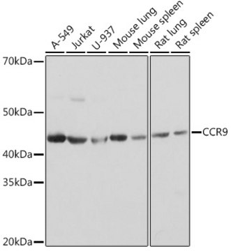 Anti-CCR9 Antibody, clone 4F7Q6, Rabbit Monoclonal