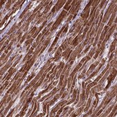 Anti-OXCT1 antibody produced in rabbit Prestige Antibodies&#174; Powered by Atlas Antibodies, affinity isolated antibody, buffered aqueous glycerol solution