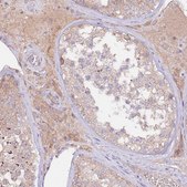 Anti-FLVCR1 antibody produced in rabbit Prestige Antibodies&#174; Powered by Atlas Antibodies, affinity isolated antibody, buffered aqueous glycerol solution