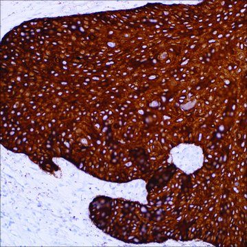 Cytokeratin 14 (SP53) Rabbit Monoclonal Antibody