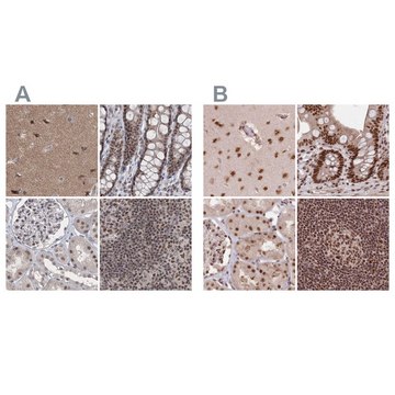Anti-PDS5A antibody produced in rabbit Prestige Antibodies&#174; Powered by Atlas Antibodies, affinity isolated antibody, buffered aqueous glycerol solution