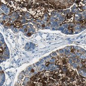 Anti-MUC4 antibody produced in rabbit Prestige Antibodies&#174; Powered by Atlas Antibodies, affinity isolated antibody, buffered aqueous glycerol solution
