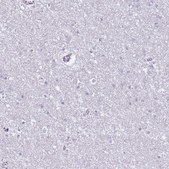 Anti-CD177 antibody produced in rabbit Prestige Antibodies&#174; Powered by Atlas Antibodies, affinity isolated antibody