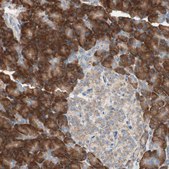Anti-RPL23 antibody produced in rabbit affinity isolated antibody, buffered aqueous glycerol solution