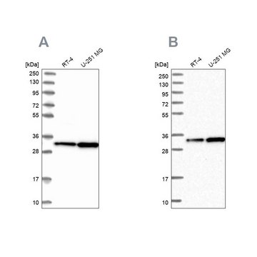 Anti-TBCB antibody produced in rabbit Prestige Antibodies&#174; Powered by Atlas Antibodies, affinity isolated antibody, buffered aqueous glycerol solution