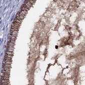 Anti-SERPINA3 antibody produced in rabbit Prestige Antibodies&#174; Powered by Atlas Antibodies, affinity isolated antibody, buffered aqueous glycerol solution