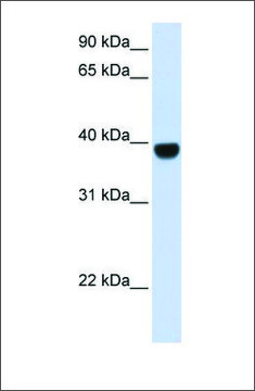 Anti-FOXE1 antibody produced in rabbit affinity isolated antibody