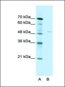 Anti-TRIM38 (AB1) antibody produced in rabbit affinity isolated antibody