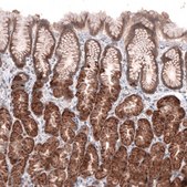 Anti-ACSL3 antibody produced in rabbit Prestige Antibodies&#174; Powered by Atlas Antibodies, affinity isolated antibody, buffered aqueous glycerol solution