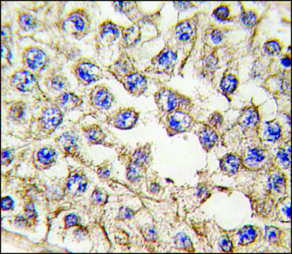 Anti-EPHA10 (center) antibody produced in rabbit saturated ammonium sulfate (SAS) precipitated, buffered aqueous solution