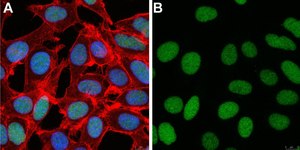 Anti-ZEB1 Antibody, clone 5C20 ZooMAb&#174; Rabbit Monoclonal recombinant, expressed in HEK 293 cells