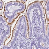 Anti-SLC7A9 antibody produced in rabbit Prestige Antibodies&#174; Powered by Atlas Antibodies, affinity isolated antibody, buffered aqueous glycerol solution