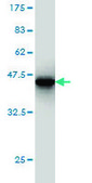 Monoclonal Anti-HIP1 antibody produced in mouse clone 1F12, purified immunoglobulin, buffered aqueous solution