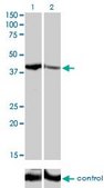 Monoclonal Anti-SHOX2 antibody produced in mouse clone 1D1, purified immunoglobulin, buffered aqueous solution