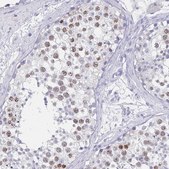 Anti-SYCP3 antibody produced in rabbit Prestige Antibodies&#174; Powered by Atlas Antibodies, affinity isolated antibody, buffered aqueous glycerol solution