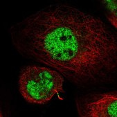 Anti-KIF4A antibody produced in rabbit Prestige Antibodies&#174; Powered by Atlas Antibodies, affinity isolated antibody, buffered aqueous glycerol solution
