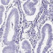 Anti-DDX4 antibody produced in rabbit Prestige Antibodies&#174; Powered by Atlas Antibodies, affinity isolated antibody, buffered aqueous glycerol solution
