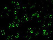 Anti-IKK beta antibody produced in rabbit affinity isolated antibody