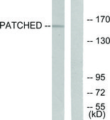 Anti-PATCHED, N-Terminal antibody produced in rabbit affinity isolated antibody