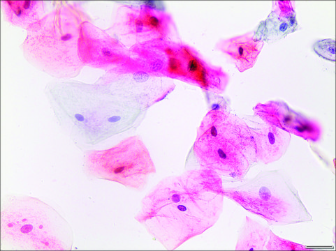 Papanicolaou Stain, Modified EA 65